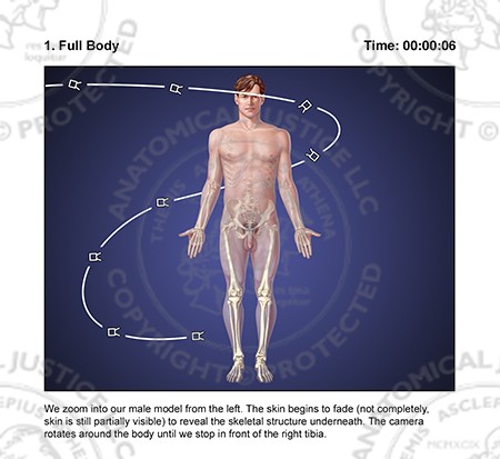 Tibial Fracture, Reduction and External Fixation Storyboards